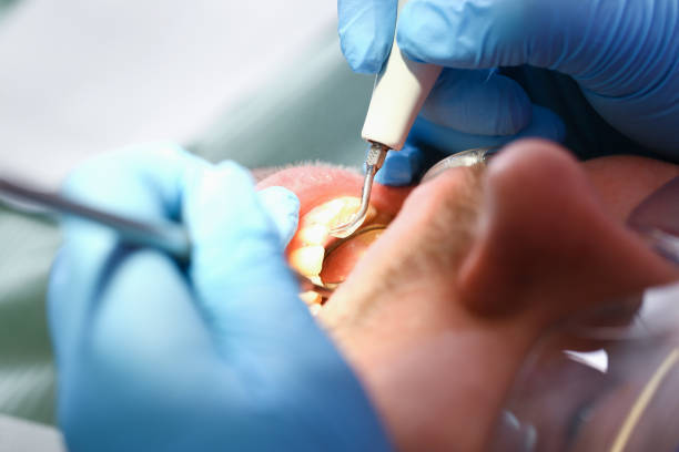 Best Emergency Broken Tooth Repair in Berkley, MI