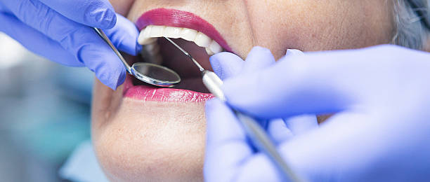 Best Emergency Tooth Extraction in Berkley, MI